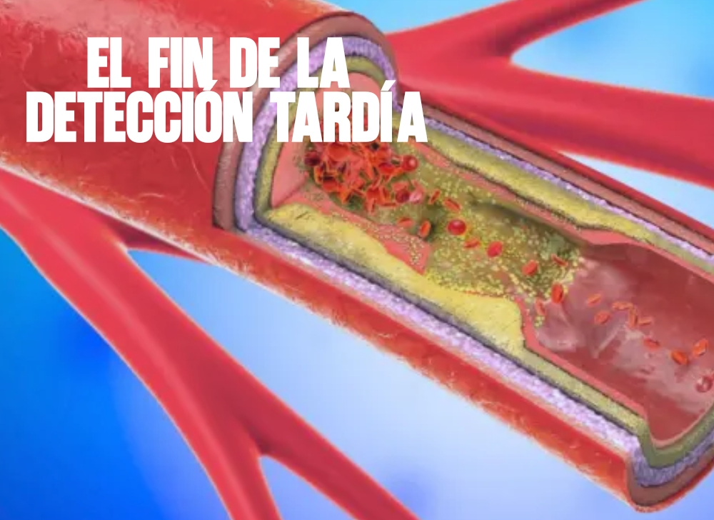 ​El fin de la detección tardía